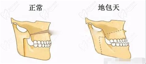 反頜意思